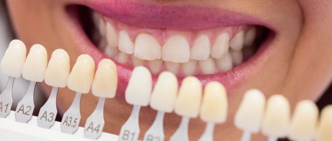 Blanqueamiento dental (Foto: Freepik)
