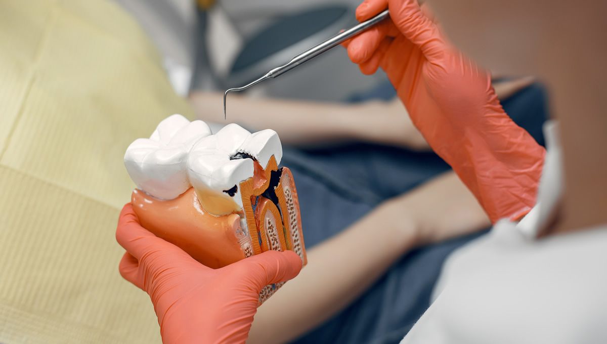 Dentista mostrando una caries (Foto: Freepik)