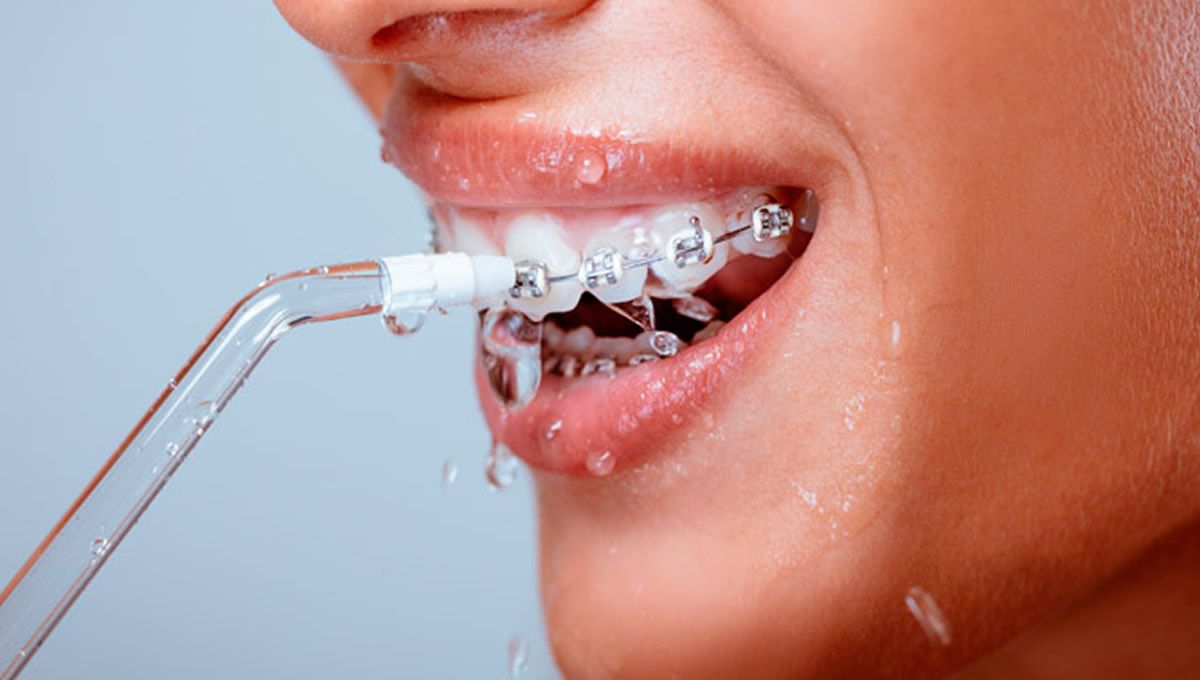 Irrigador dental (Fuente: Polydentia)
