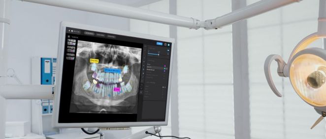 Sistema de análisis de radiografías por IA (Fuente: hellopearl)