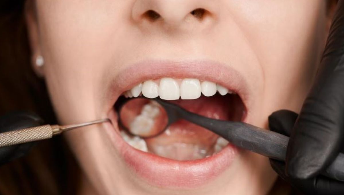 Dentista examinando caries (Fuente: Freepik)