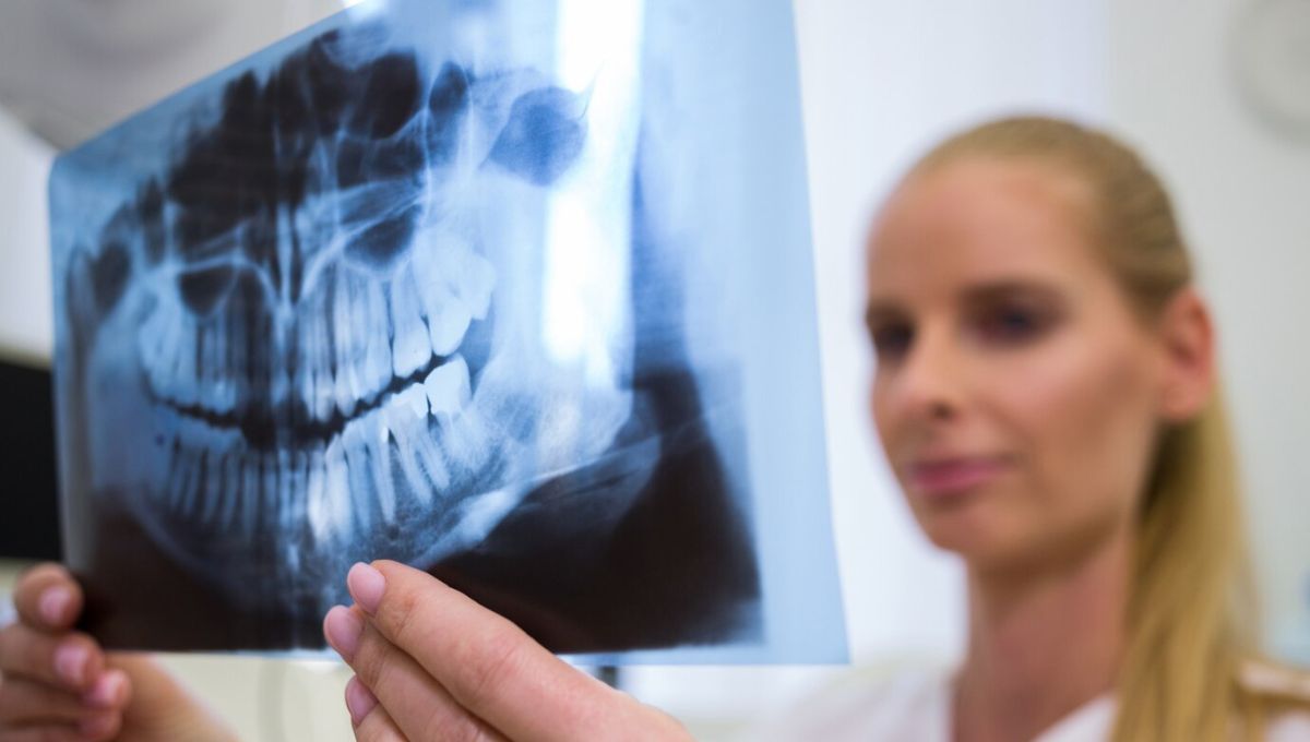 Dentista mirando una radiografia Fuente Freepik