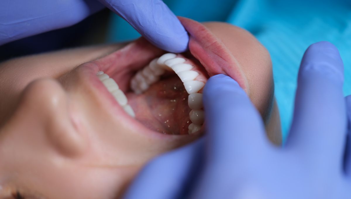 Odontólogo revisando carillas en un paciente (Fuente: Canva)
