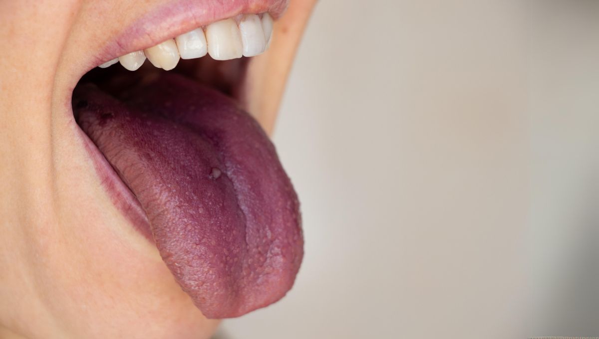 Mujer mostrando la lengua (Fuente: Canva)