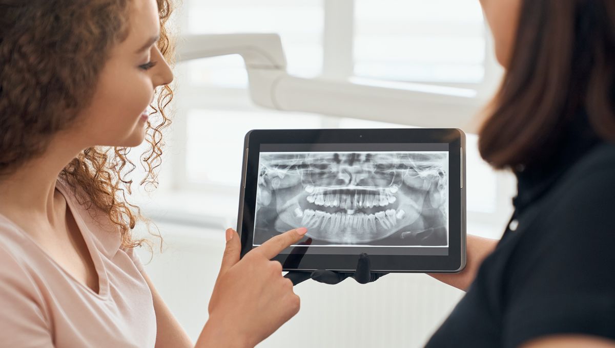 Radiografía de paciente con dientes desgastados (Foto. Freepik)