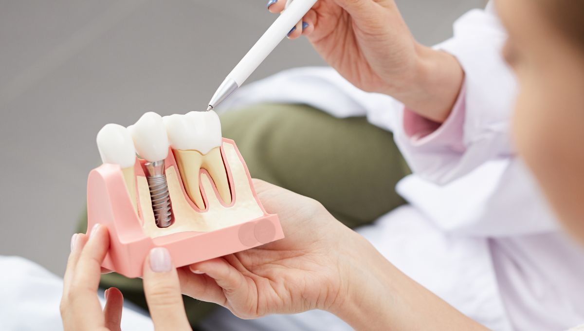 Dentista mostrando implante a un paciente (Fuente: Canva)