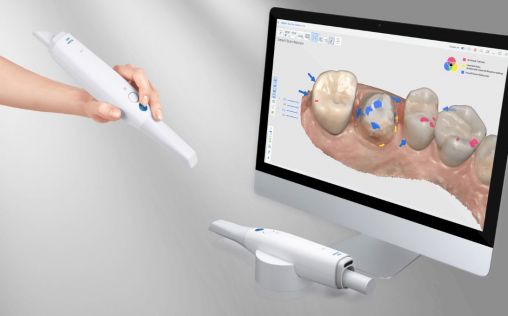 Medit anuncia el lanzamiento de su escáner dental 3D i900 que "transformará la atención al paciente"
