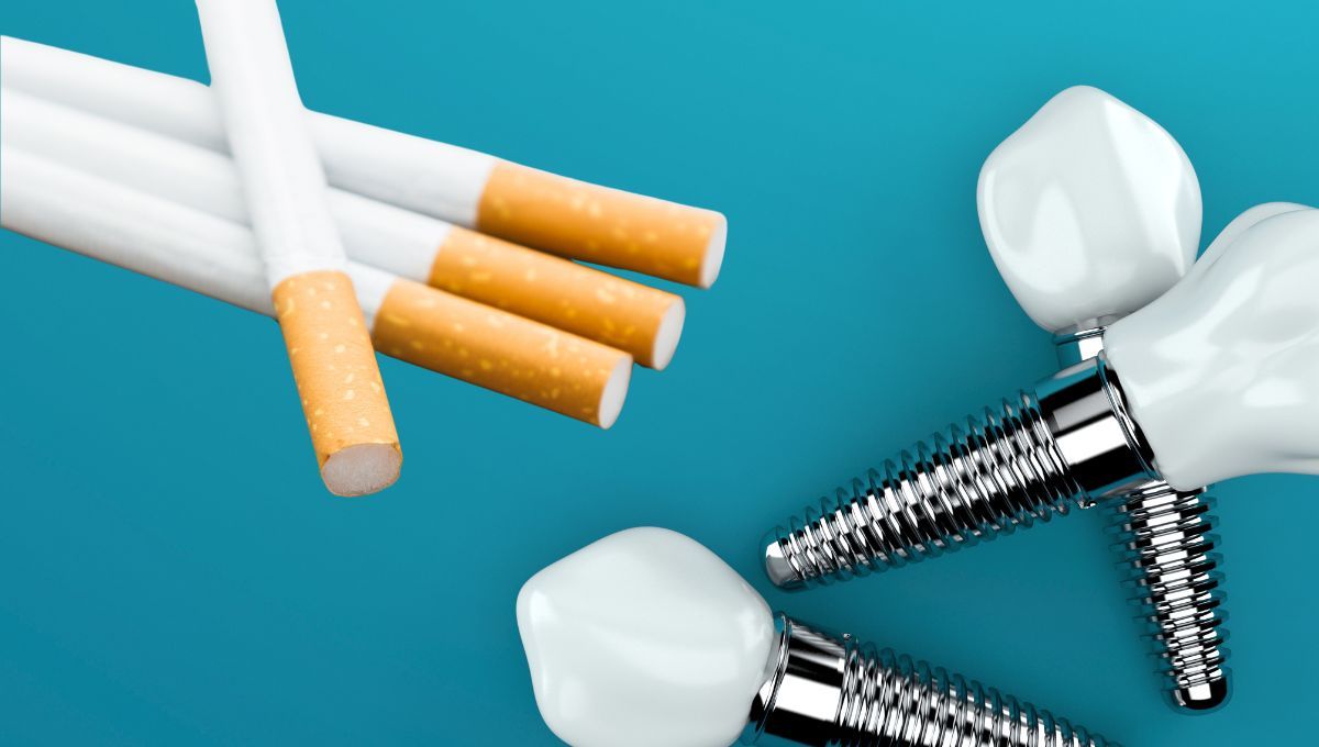 Tabaco e implantes dentales (Montaje Consalud)