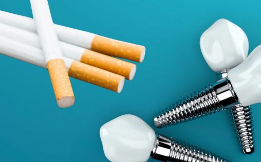 Así impacta el tabaco en los implantes dentales