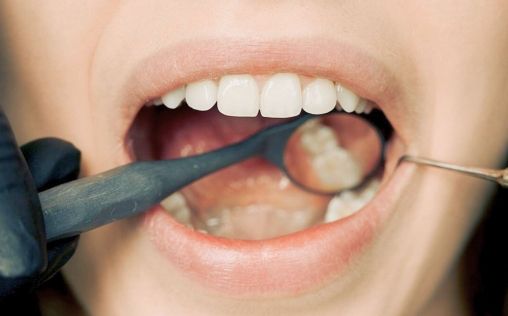 Así afecta la nutrición a la erosión de nuestros dientes