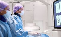 Philips acelera el diagnóstico y el tratamiento del accidente cerebrovascular