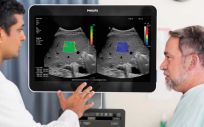 Philips avanza en la cartera de ultrasonidos con nuevas herramientas de imágenes para radiología