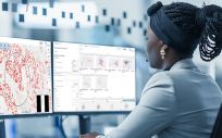 Aiforia prepara otra aprobación de un nuevo modelo de IA para cáncer de mama en Europa