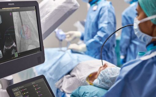 Philips lanza EchoNavigator 4.0 para tratar cardiopatías estructurales con más facilidad y eficacia