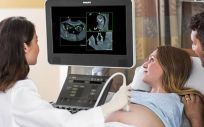 Philips presenta el software de intercambio de imágenes de ecografía fetal FetView