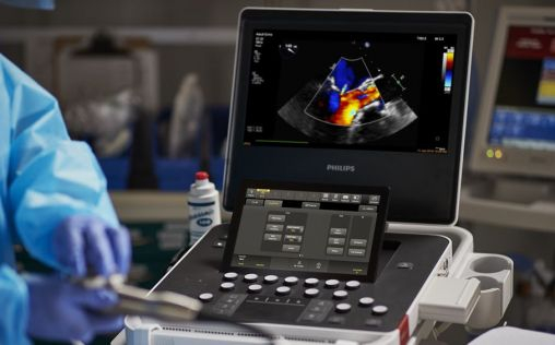 Philips lanza un nuevo sistema de ultrasonidos que permite diagnosticar a más pacientes