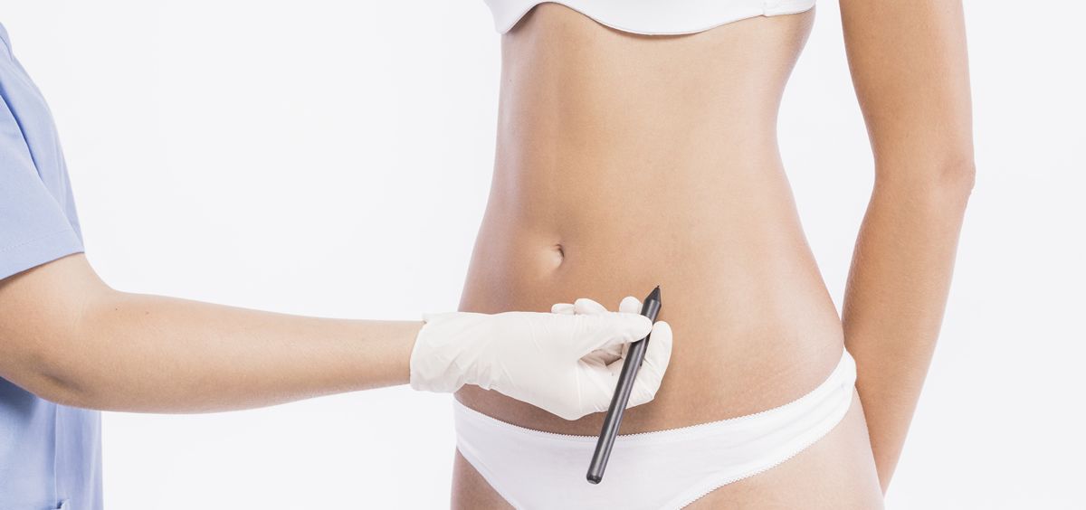 La liposucción sigue siendo una de las cirugías estéticas más demandadas (Foto. Freepik)