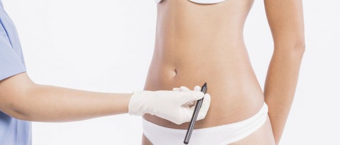 La liposucción sigue siendo una de las cirugías estéticas más demandadas (Foto. Freepik)