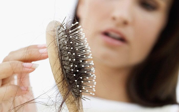 Pérdida femenina de cabello, ¿cómo saber si se trata de alopecia androgénica?