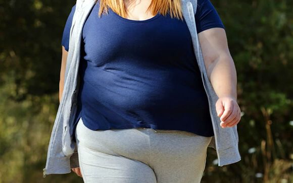 Mujer con obesidad (Foto. Freepik)