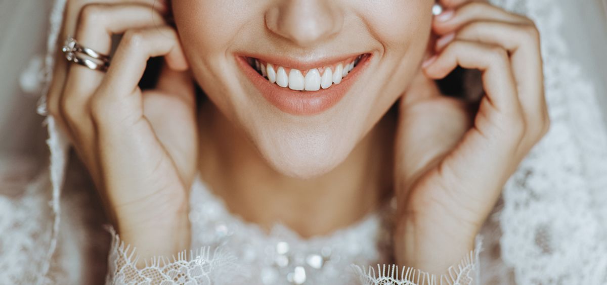 Descubre cómo lucir una sonrisa perfecta el día de tu boda (Foto. Freepik)