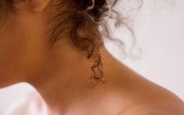 Arrugas en el cuello (Foto. Estetic)