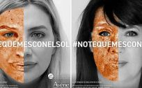 Campaña #Notequemesconelsol2022 (Foto. Avène)