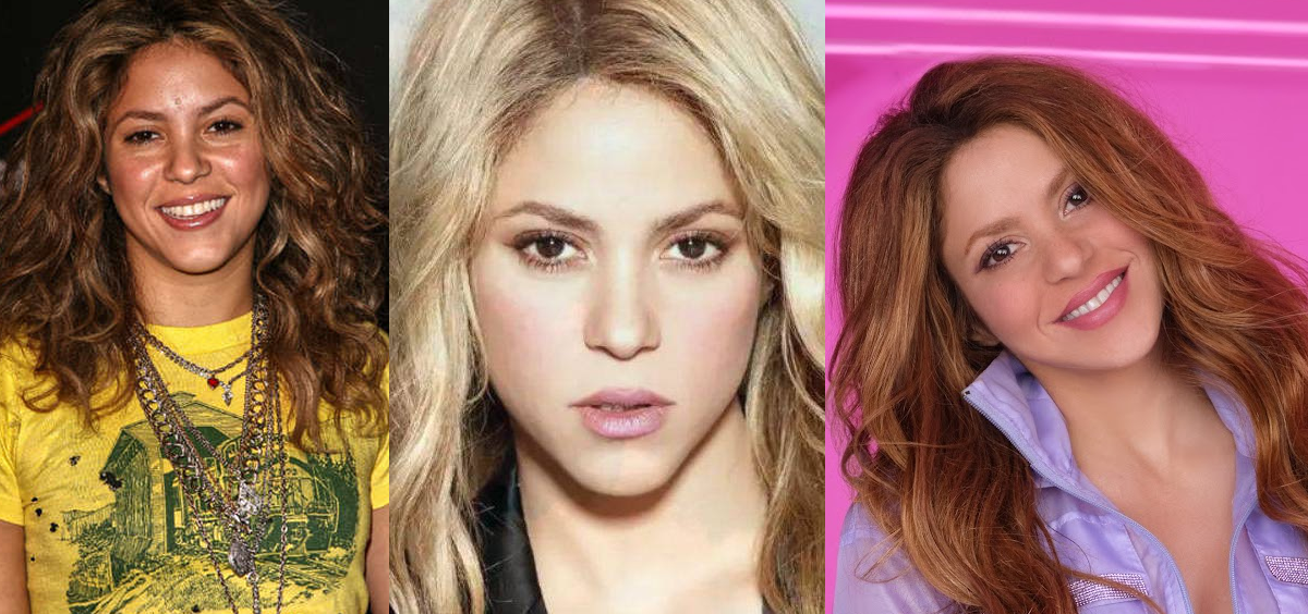 Operaciones estéticas Shakira (Foto. Fotomontaje Estetic.es)