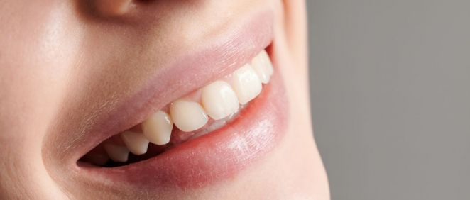 Sonrisa femenina con dientes blancos (Foto. Freepik)