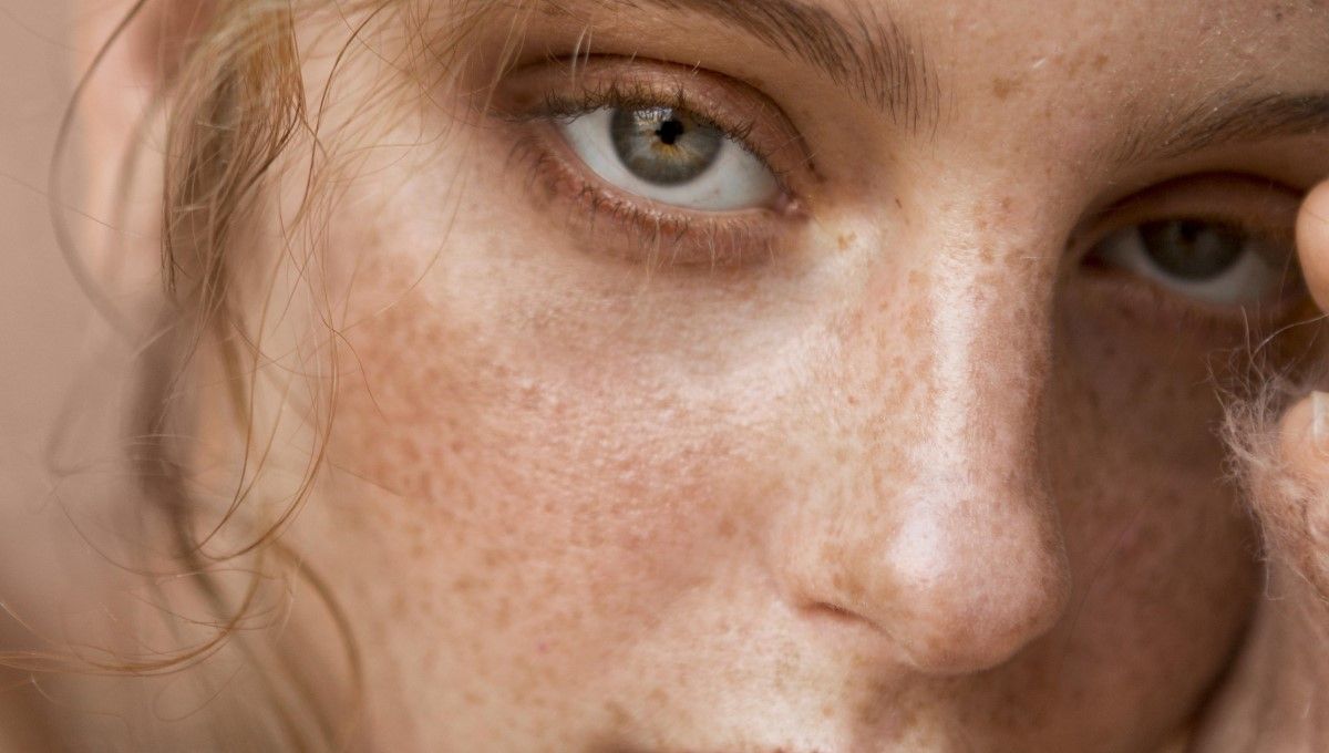 Mujer con manchas en el rostro (Foto. Freepik)