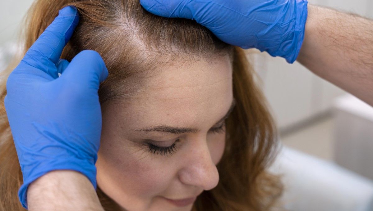 Doctor examinando el cuero cabelludo de una paciente (Foto. Freepik)