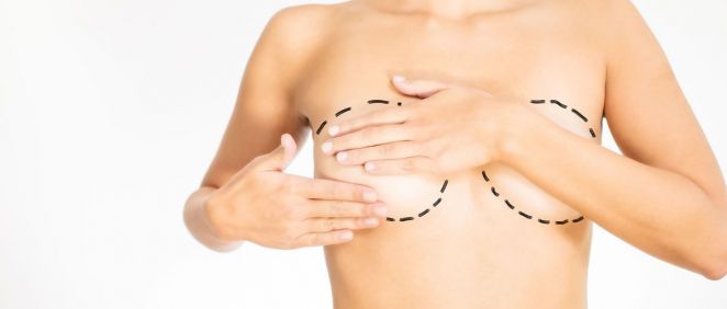 Secuelas mamarias tras sometarte a una operación