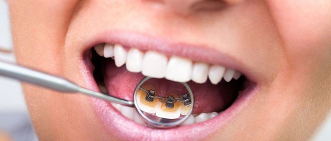 Existen cinco problemas dentales muy comunes entre la población