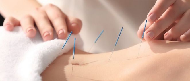 La acupuntura puede aliviar los síntomas de muchas enfermedades e incluso evitar el avance de las mismas