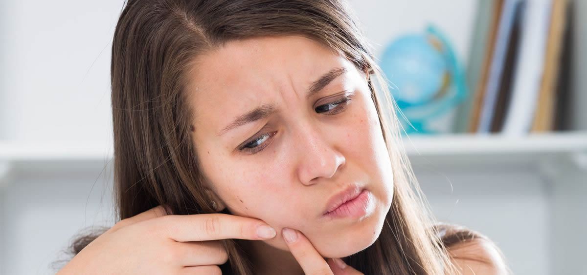 El acné puede resultar muy desagradable para aquellos que lo sufren