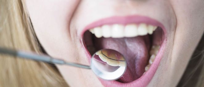 Existen distintos tipos de ortodoncia según las necesidades del paciente