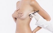 La elevación de pecho es una de las cirugías más solicitadas por las mujeres