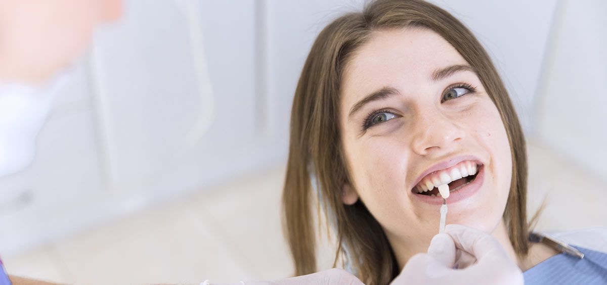 Todo lo que debes saber sobre las carillas dentales