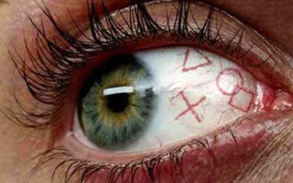  Tatuajes dentro del ojo: ¿tendencia o riesgo?