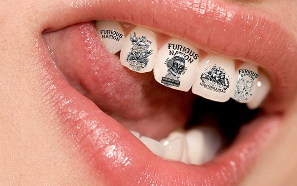 Tatuajes dentales, una nueva tendencia agresiva para la sonrisa