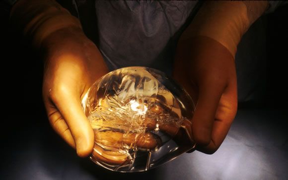 Implantes mamarios: tipos, ventajas y problemas