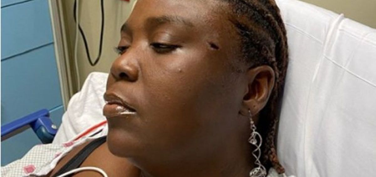 Shakena tenía alojada una bala en el cráneo por lo que tuvo que ser sometida a una cirugía de urgencia (Foto. Miami Diario)