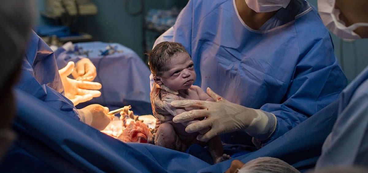 Isabela tras su nacimiento (Foto. Facebook Rodrigo Kunstmann)