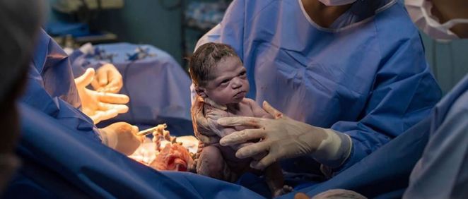 Isabela tras su nacimiento (Foto. Facebook Rodrigo Kunstmann)