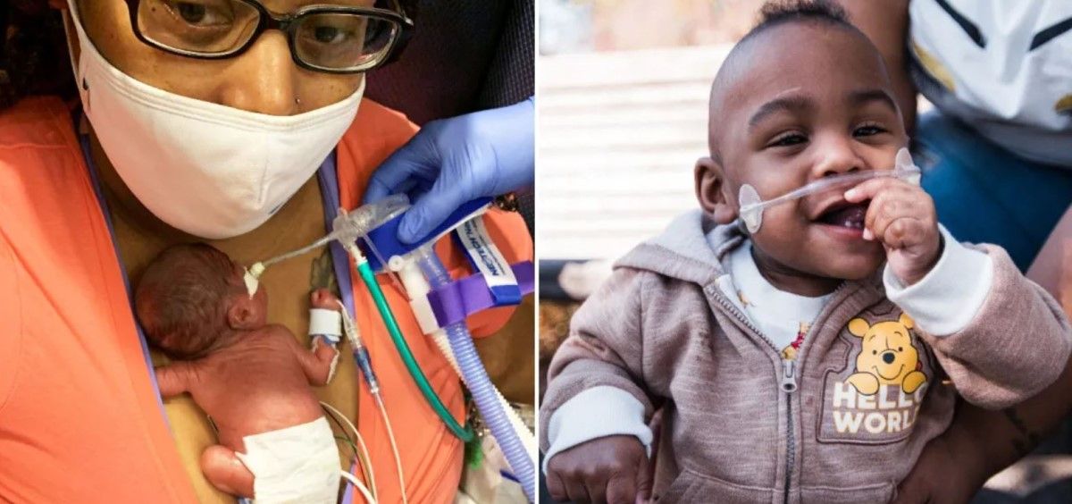 Curtis, el bebé más prematuro del mundo y su madre, Chelly. (Foto. Guinness World Record)