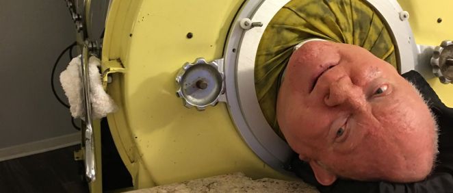 Paul Richard Alexander, paciente de polio que llevaba más de 70 años inmovilizado de cintura para abajo y encerrado dentro de un gigantesco pulmón de acero (FOTO: @kakape)