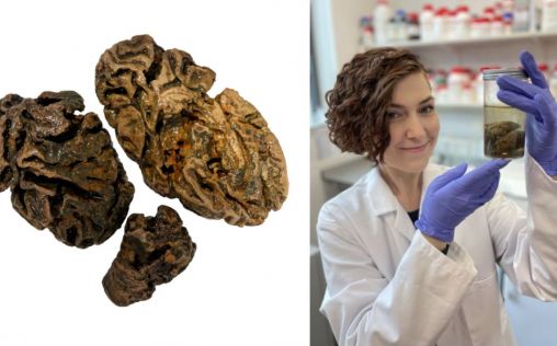 Oxford comparte el descubrimiento de cerebros humanos bien conservados con 12.000 años de antigüedad