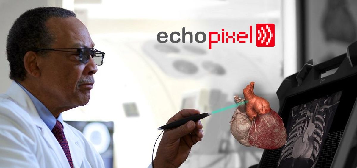 EchoPixel presenta un software holográfico en 3D para planificar procedimientos cardíacos. (Foto. Fotomontaje ConSalud)