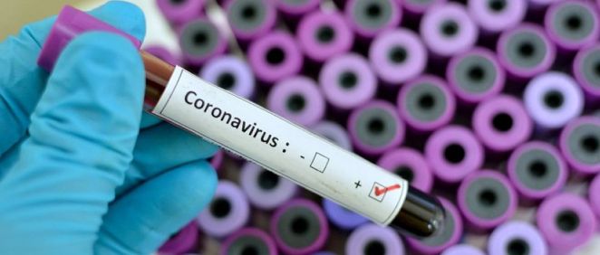 Coronavirus (Foto. Farmaindustria)