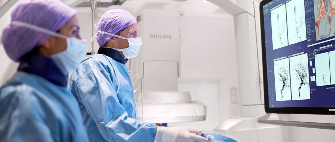 Philips acelera el diagnóstico y el tratamiento del accidente cerebrovascular